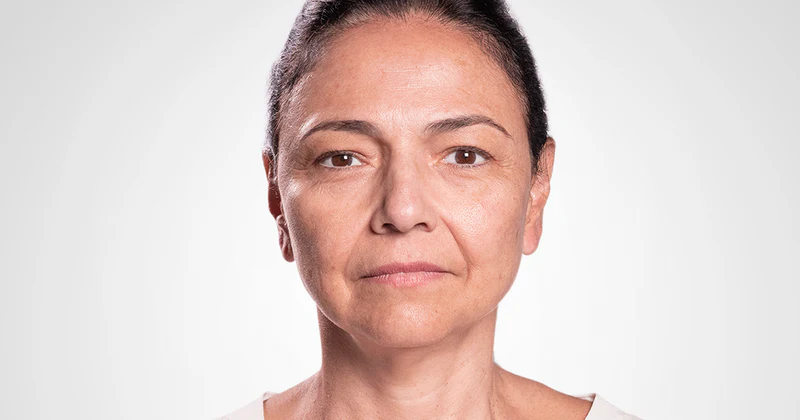 facial_serum_antes.webp