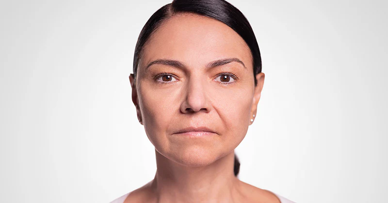 facial_serum_depois.webp facial_serum_depois.webp